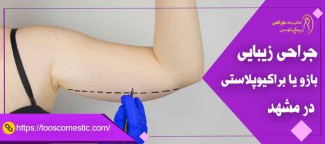 جراحی زیبایی بازو یا براکیوپلاستی در مشهد