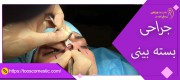 فواید و عوارض جراحی بسته بینی