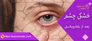 خشکی چشم بعد از عمل بلفاروپلاستی